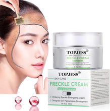 Carica l'immagine nel visualizzatore di Gallery, Crema Sbiancante, Sbiancante,Whitening Cream,Crema Macchie Macchie...