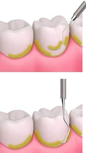 Carica l'immagine nel visualizzatore di Gallery, Dentale Sbiancamento dei denti Tartaro e targa Rimozione Sonda a specchio Kit - Ilgrandebazar