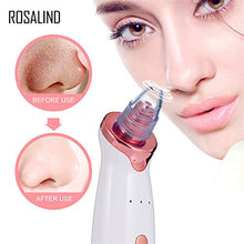 Carica l'immagine nel visualizzatore di Gallery, ROSALIND Aspiratore Punti Neri Elettrico, Blackhead Remover Timozione Punti... - Ilgrandebazar
