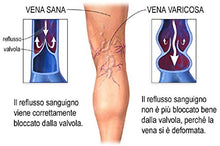 Carica l'immagine nel visualizzatore di Gallery, CREMA CONTRO LE VENE VARICOSE PRIMO CLASSIFICATO 2019-2020 VARICASTAN