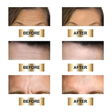 Carica l'immagine nel visualizzatore di Gallery, Patch Antirughe,Cerotti Antirughe Fronte,Anti Wrinkle Patches,maschera... - Ilgrandebazar