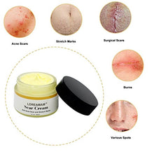 Carica l'immagine nel visualizzatore di Gallery, LDREAMAM Crema anti cicatrici, 50 ml - Ilgrandebazar
