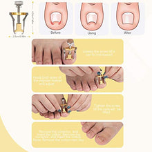 Carica l'immagine nel visualizzatore di Gallery, AGPTEK Kit Pedicure Professionale da 18 Pezzi Lime in Acciaio Inossidabile...
