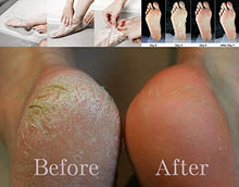 Carica l'immagine nel visualizzatore di Gallery, Maschera per il piede Esfoliazione Pedicure | Per i piedi morbidi 1 Paio
