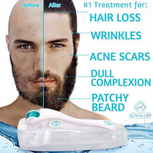 Carica l'immagine nel visualizzatore di Gallery, ALPHALUXY Dermaroller 0.5 mm - Microneedling Kit per Cicatrici Acne, Aumento... - Ilgrandebazar