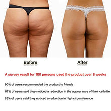 Carica l'immagine nel visualizzatore di Gallery, Cupping Anti-Cellulite in Silicone, KINDAX 2pcs Coppettazione Coppe... - Ilgrandebazar
