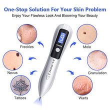 Carica l'immagine nel visualizzatore di Gallery, Verruche Rimozione, ALDOM Spot Eraser Pro, Mole Removal Pen con LED Display...