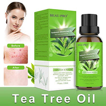 Carica l'immagine nel visualizzatore di Gallery, Tea Tree Oil, Olio Puro 100%, Naturale Essenziale per...