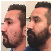 Carica l'immagine nel visualizzatore di Gallery, Derma Roller - Kit per la crescita della barba, Dermaroller con 540 aghi,...
