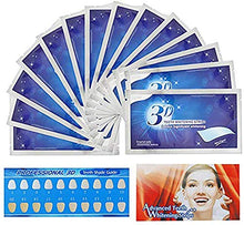 Carica l'immagine nel visualizzatore di Gallery, Sbiancanti Dentale,Sbiancamento Dei Denti,Teeth Whitening,Efficace Contro il...