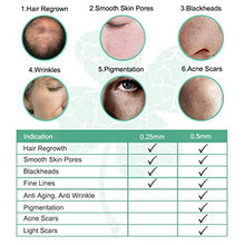 Carica l'immagine nel visualizzatore di Gallery, Anmyox Derma Roller Micro aghi Kit per viso e corpo, clear-green - Ilgrandebazar