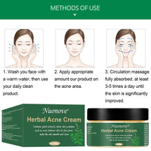Carica l'immagine nel visualizzatore di Gallery, Acne Crema, Crema Anti Acne, Cicatrici Viso... - Ilgrandebazar