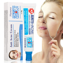 Carica l'immagine nel visualizzatore di Gallery, Acne Crema, Crema Anti Acne, Cicatrici Viso 30g - Ilgrandebazar