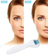 Carica l'immagine nel visualizzatore di Gallery, Winpok Dermaroller, 6 in 1 Derma Roller Kit, 12/300/ 720/1200 Aghi, bianco - Ilgrandebazar
