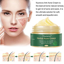 Carica l'immagine nel visualizzatore di Gallery, Acne Crema, Crema Anti Acne, Cicatrici Viso... - Ilgrandebazar