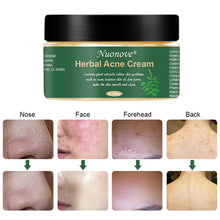 Carica l'immagine nel visualizzatore di Gallery, Acne Crema, Crema Anti Acne, Cicatrici Viso... - Ilgrandebazar