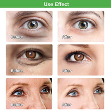 Carica l'immagine nel visualizzatore di Gallery, Maschera per gli occhi, Eye Patch, d'occhio del collagene, verde - Ilgrandebazar