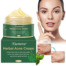 Carica l'immagine nel visualizzatore di Gallery, Acne Crema, Crema Anti Acne, Cicatrici Viso... - Ilgrandebazar