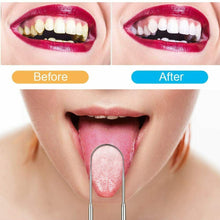 Carica l'immagine nel visualizzatore di Gallery, Kit completo per rimozione tartaro e pulizia dentale, Set per denti e igiene