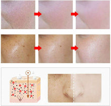 Carica l'immagine nel visualizzatore di Gallery, Crema viso Anti-Macchie, Crema Depigmentante e Schiarente, 30ml