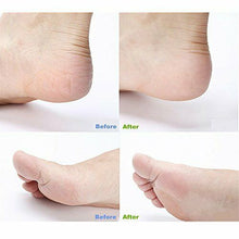 Carica l'immagine nel visualizzatore di Gallery, Pretty See, lima per pedicure e rimozione calli